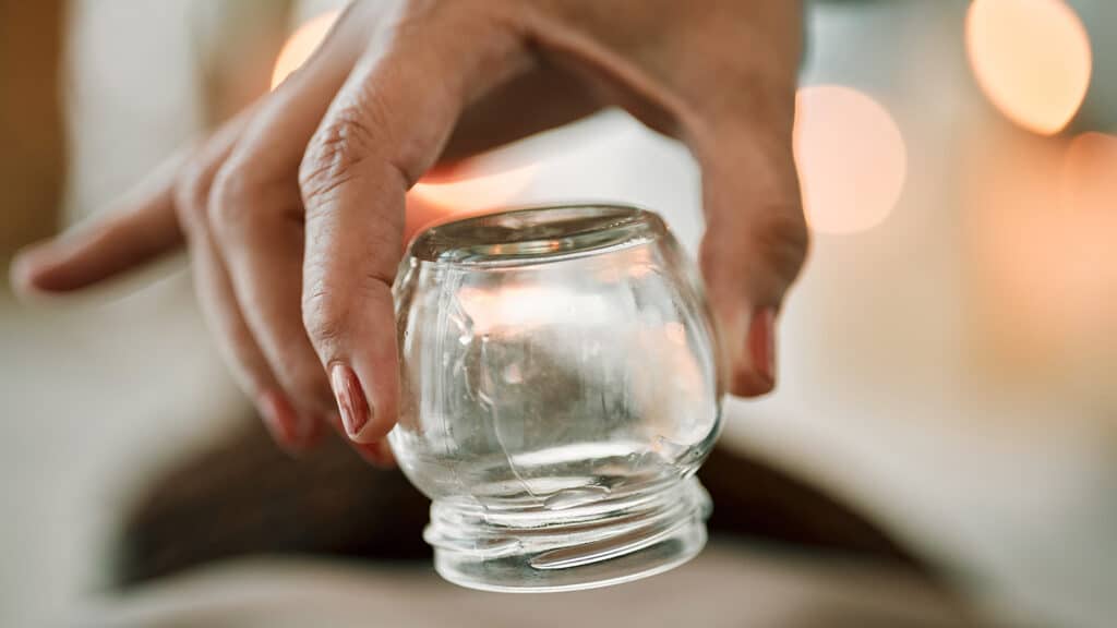 Cupping Therapy Illustration